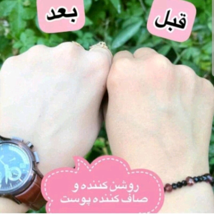 اسپری ضد آفتاب بیوآکوا (سفید کننده پوست و ضدآفتاب) آرایشی هوتران