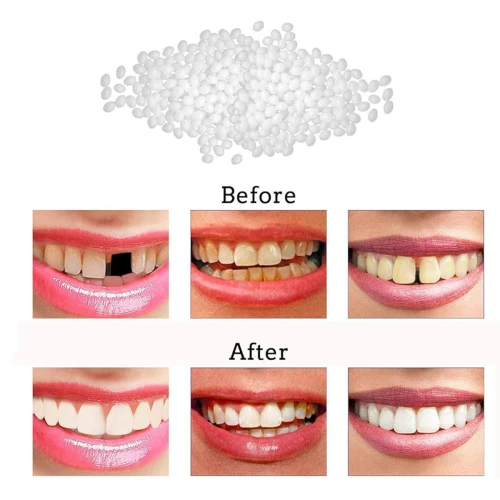 ایمپلنت فوری دندان ( نقد و اقساط ) جای خالی دندانت را خودت پر کن پروتز جادویی TEMPORARY TEETH اصل