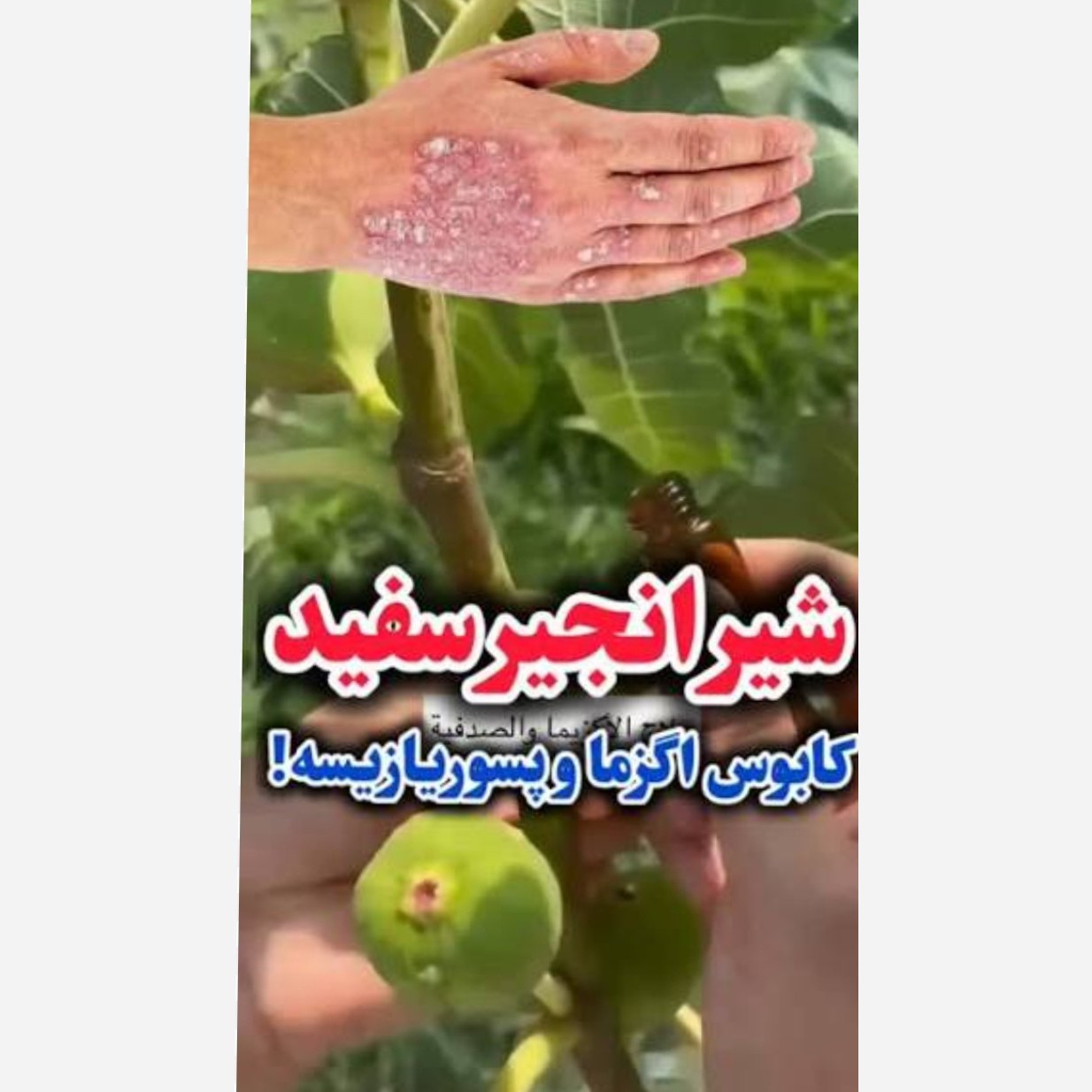 شیره سفید انجیر نارس1میلی لیتر(1سی سی)